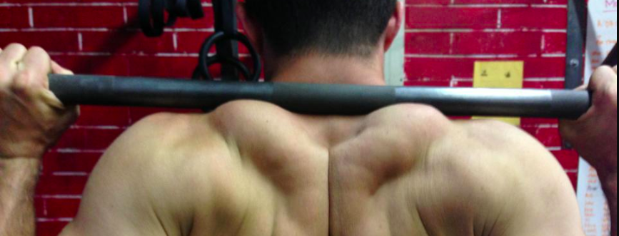 Why Does My Neck Hurt After Squats?